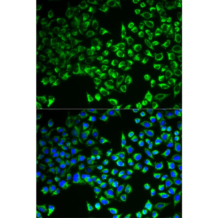 Anti-CS Antibody from Bioworld Technology (BS7809) - Antibodies.com