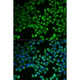 Anti-CS Antibody from Bioworld Technology (BS7809) - Antibodies.com