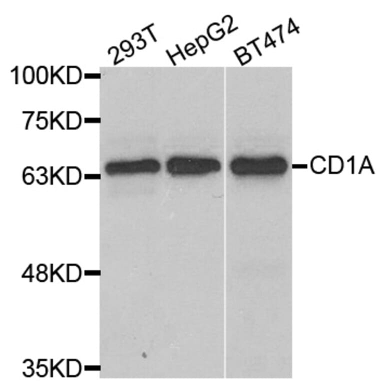 Anti-CD1A Antibody from Bioworld Technology (BS7814) - Antibodies.com