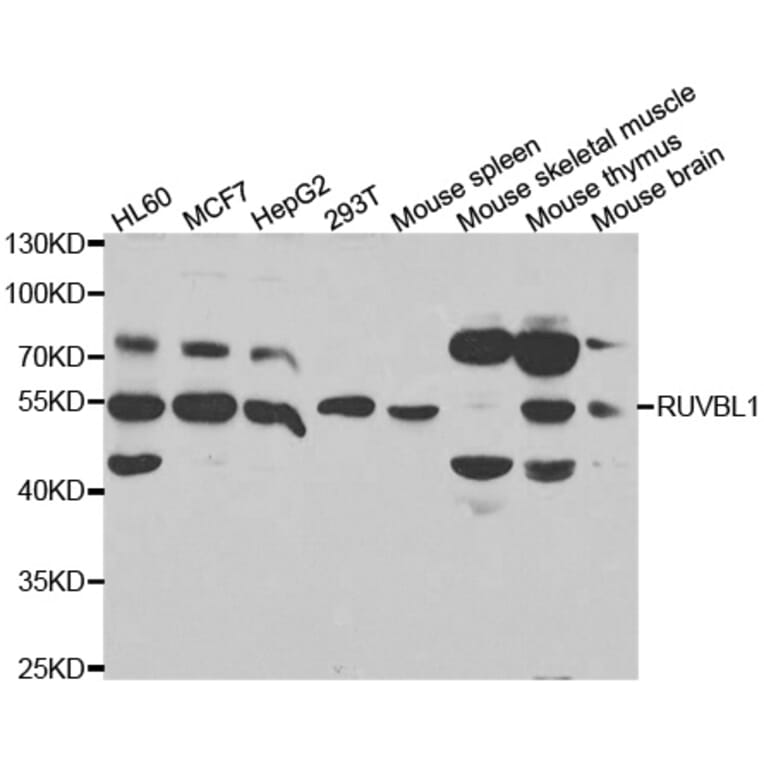 Anti-RUVBL1 Antibody from Bioworld Technology (BS7815) - Antibodies.com