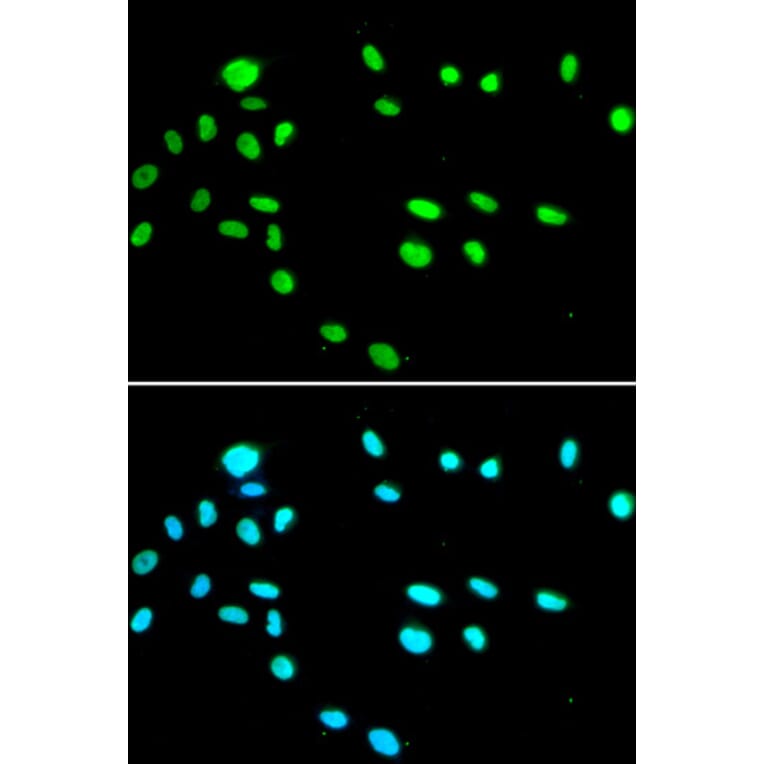 Anti-RUVBL1 Antibody from Bioworld Technology (BS7815) - Antibodies.com