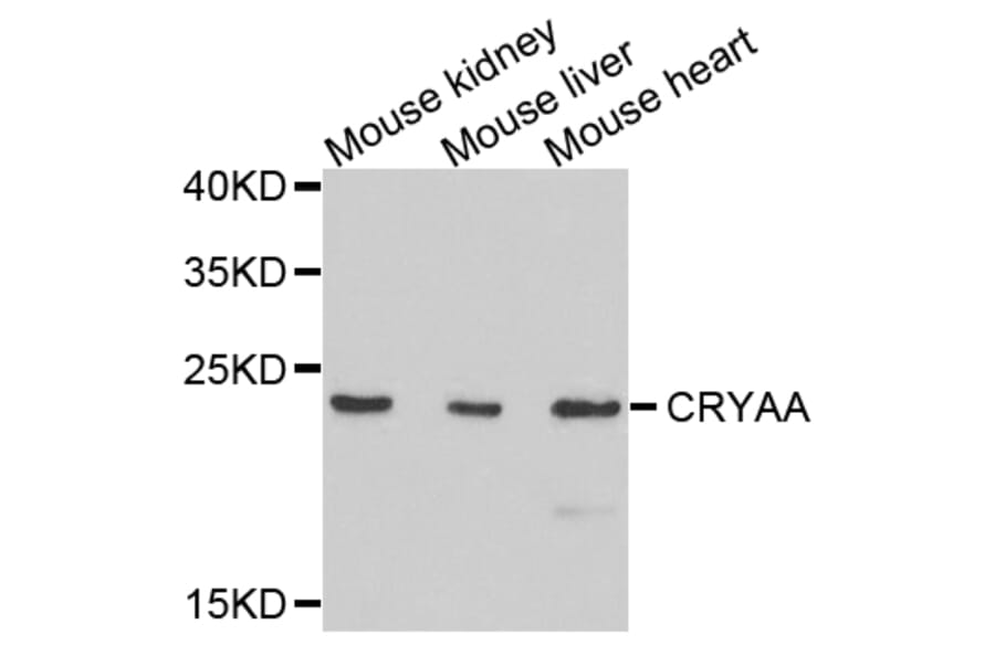 Anti-CRYAA Antibody from Bioworld Technology (BS7816) - Antibodies.com
