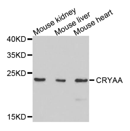 Anti-CRYAA Antibody from Bioworld Technology (BS7816) - Antibodies.com