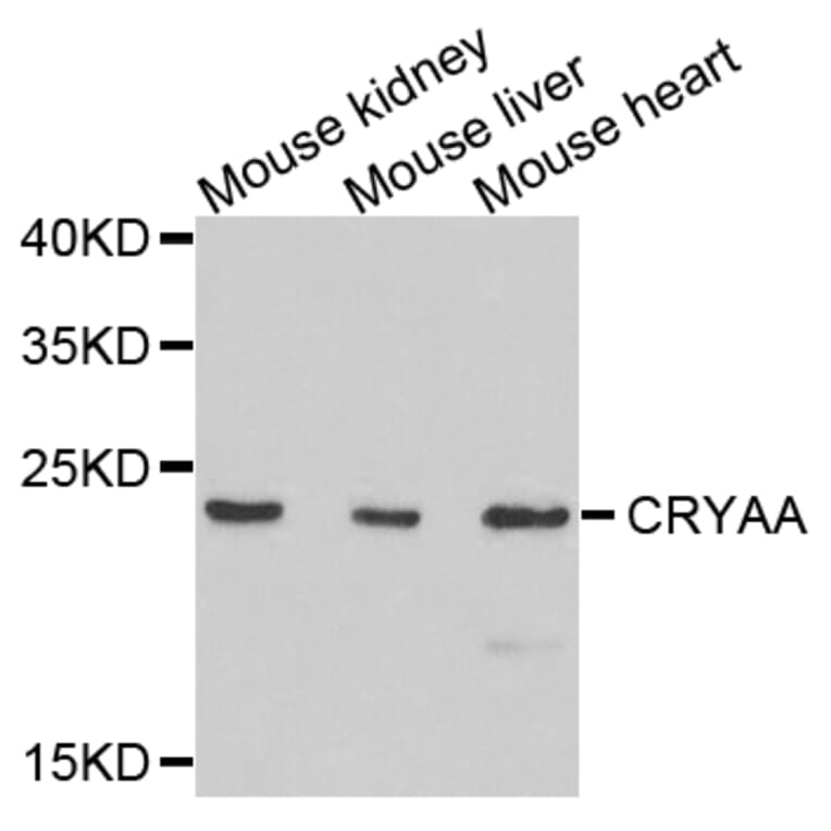 Anti-CRYAA Antibody from Bioworld Technology (BS7816) - Antibodies.com