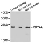 Anti-CRYAA Antibody from Bioworld Technology (BS7816) - Antibodies.com