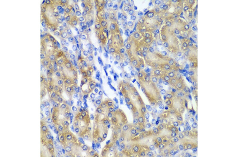 Anti-CRYAA Antibody from Bioworld Technology (BS7816) - Antibodies.com