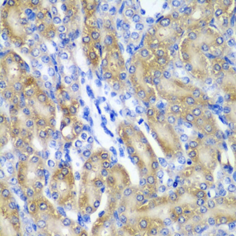 Anti-CRYAA Antibody from Bioworld Technology (BS7816) - Antibodies.com