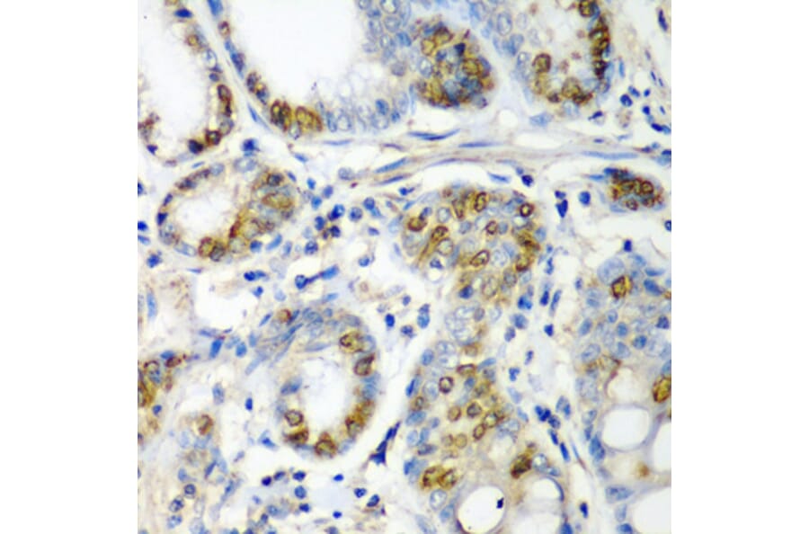 Anti-CRYAA Antibody from Bioworld Technology (BS7816) - Antibodies.com