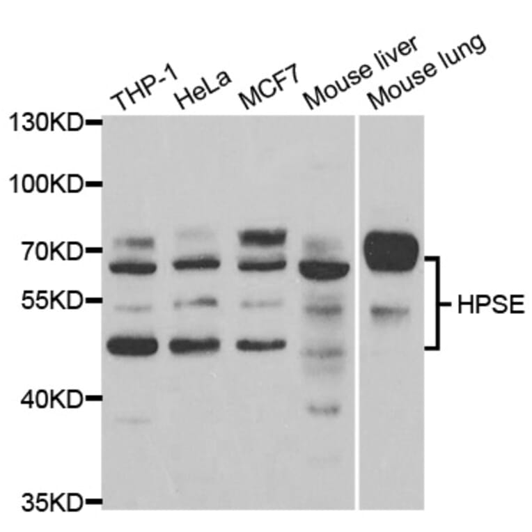 Anti-HPSE Antibody from Bioworld Technology (BS7817) - Antibodies.com