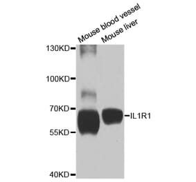 Anti-IL1R1 Antibody from Bioworld Technology (BS7818) - Antibodies.com