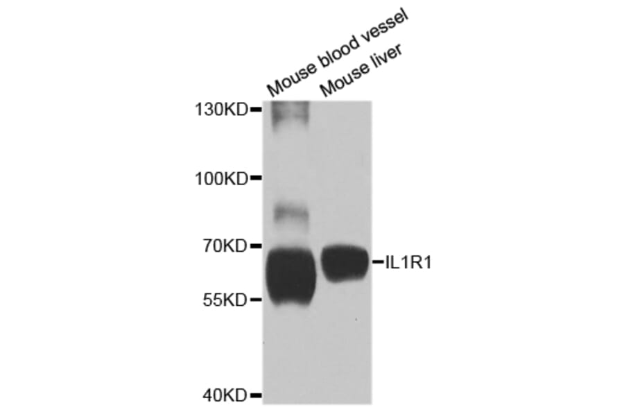 Anti-IL1R1 Antibody from Bioworld Technology (BS7818) - Antibodies.com