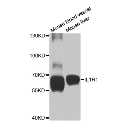 Anti-IL1R1 Antibody from Bioworld Technology (BS7818) - Antibodies.com