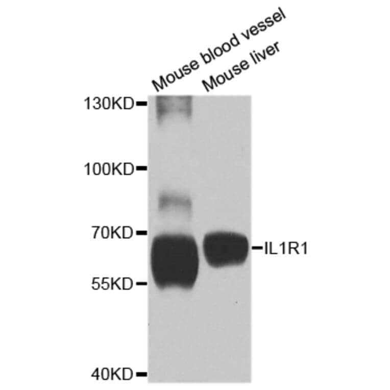 Anti-IL1R1 Antibody from Bioworld Technology (BS7818) - Antibodies.com