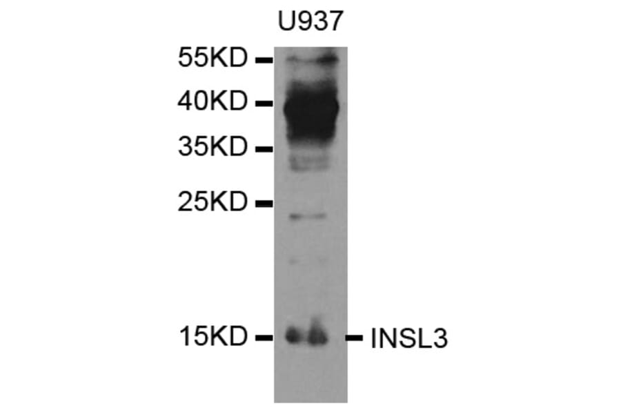 Anti-INSL3 Antibody from Bioworld Technology (BS7819) - Antibodies.com