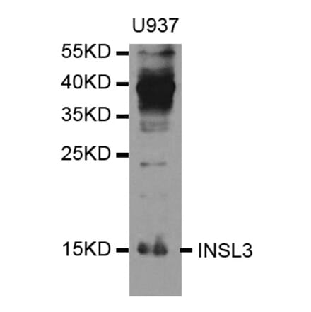 Anti-INSL3 Antibody from Bioworld Technology (BS7819) - Antibodies.com