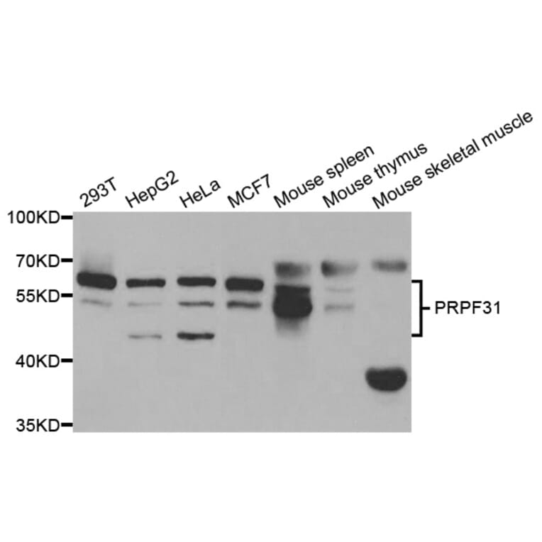 Anti-PRPF31 Antibody from Bioworld Technology (BS7821) - Antibodies.com