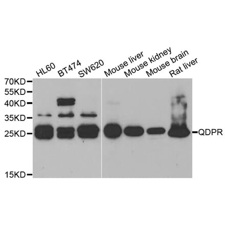 Anti-QDPR Antibody from Bioworld Technology (BS7822) - Antibodies.com