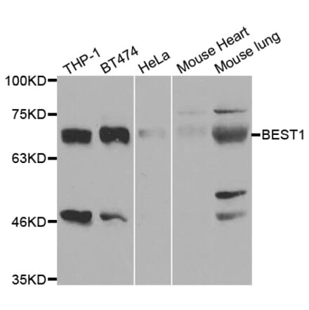 Anti-BEST1 Antibody from Bioworld Technology (BS7824) - Antibodies.com