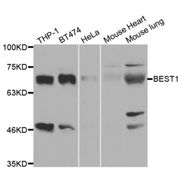 Anti-BEST1 Antibody from Bioworld Technology (BS7824) - Antibodies.com