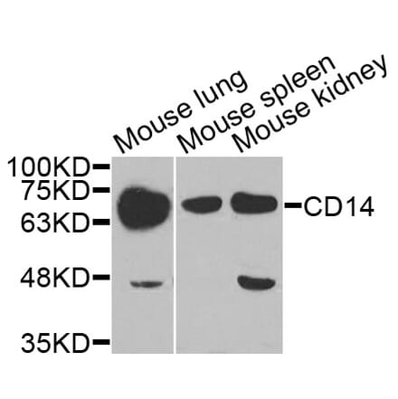 Anti-CD14 Antibody from Bioworld Technology (BS7825) - Antibodies.com