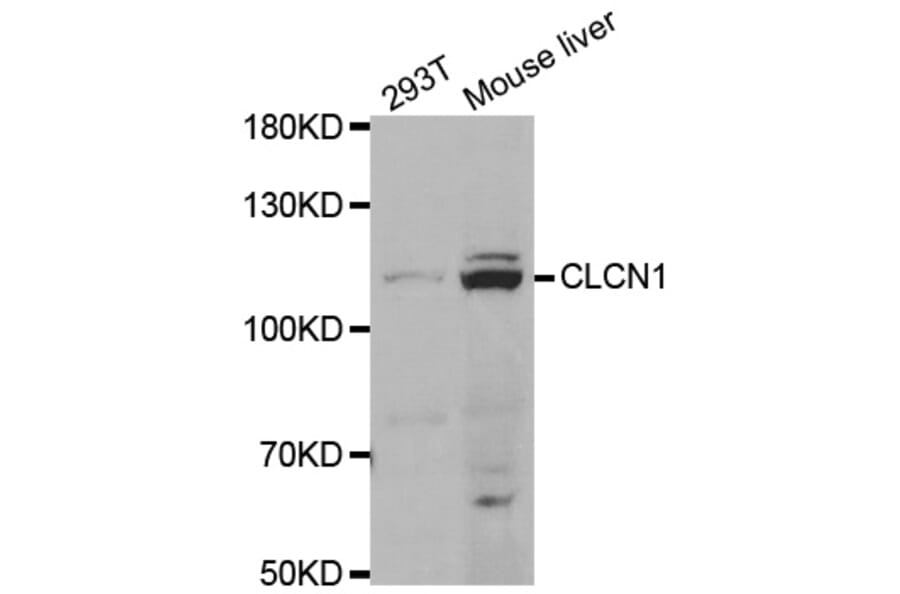 Anti-CLCN1 Antibody from Bioworld Technology (BS7826) - Antibodies.com