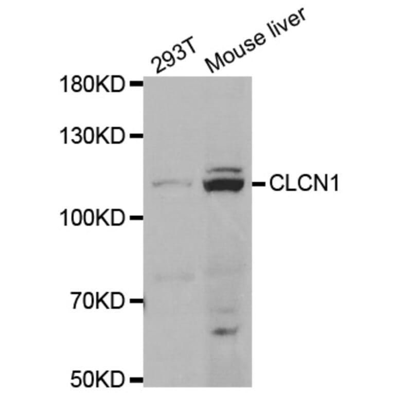 Anti-CLCN1 Antibody from Bioworld Technology (BS7826) - Antibodies.com