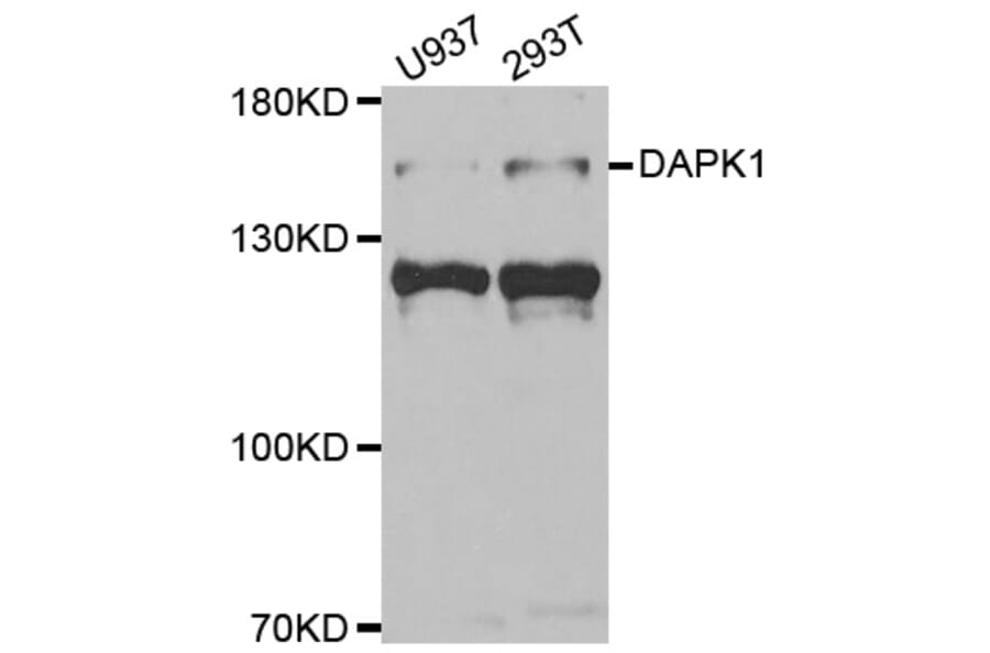 Anti-DAPK1 Antibody from Bioworld Technology (BS7828) - Antibodies.com