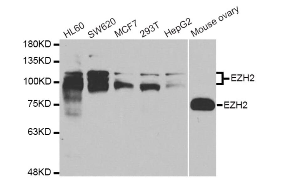 Anti-EZH2 Antibody from Bioworld Technology (BS7830) - Antibodies.com