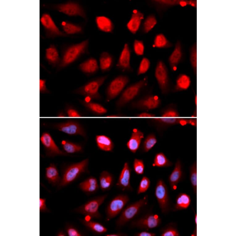 Anti-EZH2 Antibody from Bioworld Technology (BS7830) - Antibodies.com