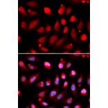 Anti-EZH2 Antibody from Bioworld Technology (BS7830) - Antibodies.com