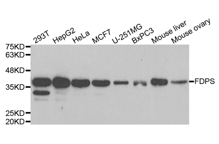 Anti-FDPS Antibody from Bioworld Technology (BS7831) - Antibodies.com