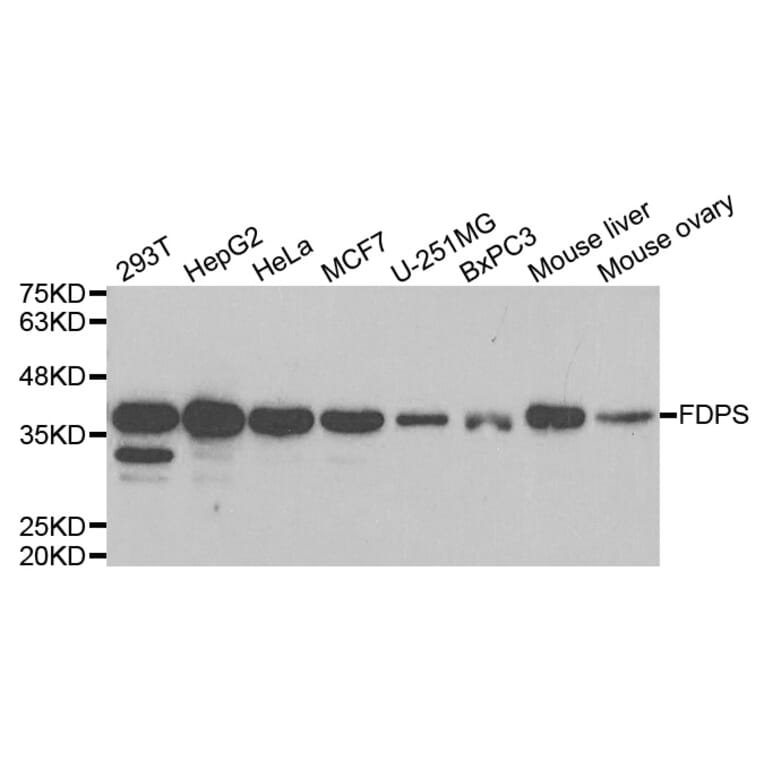 Anti-FDPS Antibody from Bioworld Technology (BS7831) - Antibodies.com