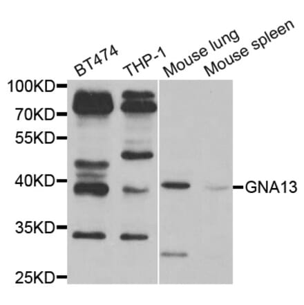 Anti-GNA13 Antibody from Bioworld Technology (BS7833) - Antibodies.com