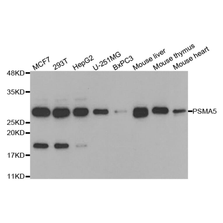 Anti-PSMA5 Antibody from Bioworld Technology (BS7836) - Antibodies.com