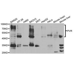 Anti-PVR Antibody from Bioworld Technology (BS7837) - Antibodies.com