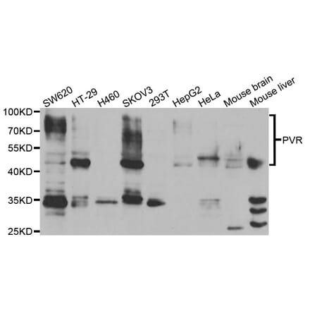 Anti-PVR Antibody from Bioworld Technology (BS7837) - Antibodies.com