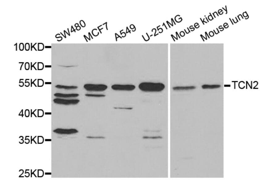 Anti-TCN2 Antibody from Bioworld Technology (BS7838) - Antibodies.com