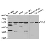 Anti-TCN2 Antibody from Bioworld Technology (BS7838) - Antibodies.com