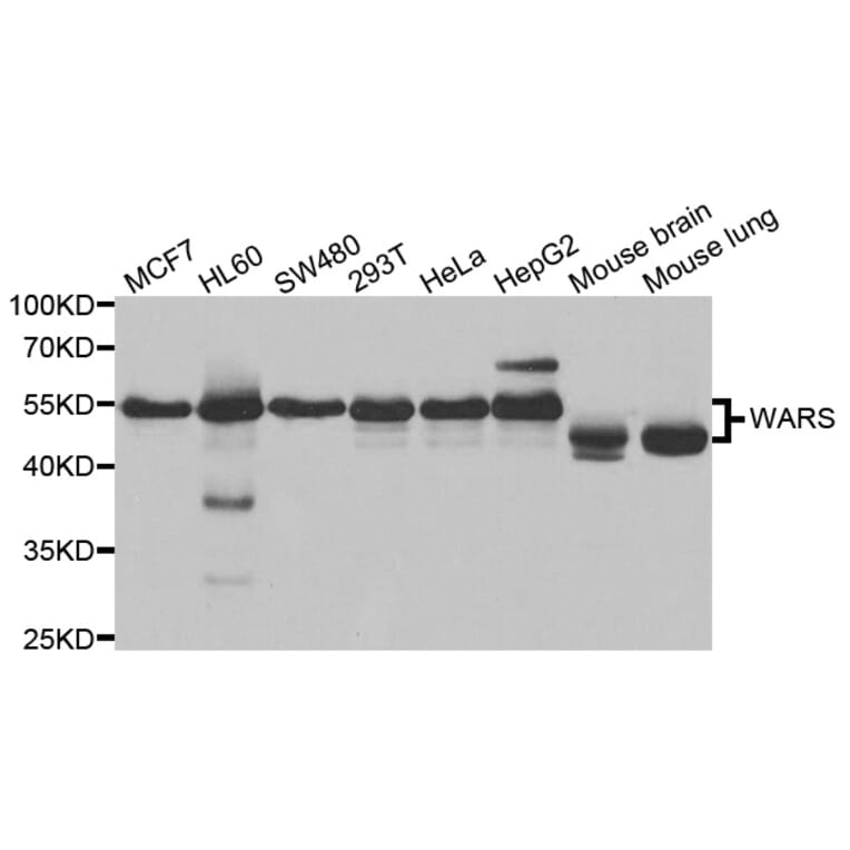 Anti-WARS Antibody from Bioworld Technology (BS7839) - Antibodies.com
