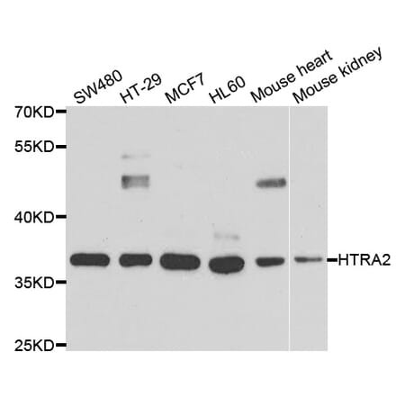Anti-HTRA2 Antibody from Bioworld Technology (BS7842) - Antibodies.com