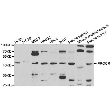 Anti-PROCR Antibody from Bioworld Technology (BS7843) - Antibodies.com