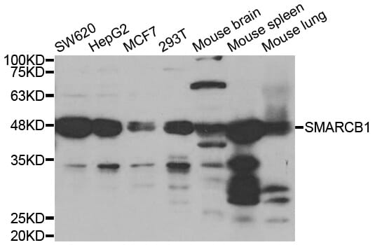 Anti-INI 1 Antibody [ABT-INI1] (A98879) | Antibodies.com