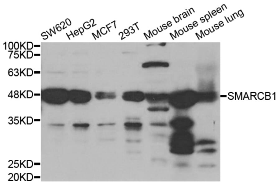 Anti-SMARCB1 Antibody from Bioworld Technology (BS7846) - Antibodies.com