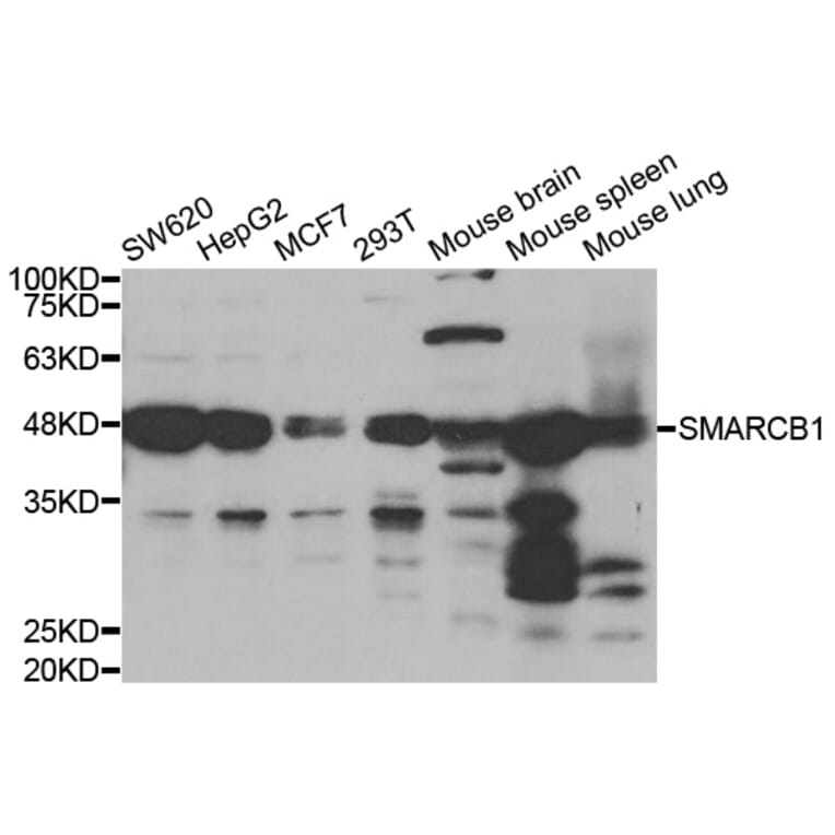 Anti-SMARCB1 Antibody from Bioworld Technology (BS7846) - Antibodies.com