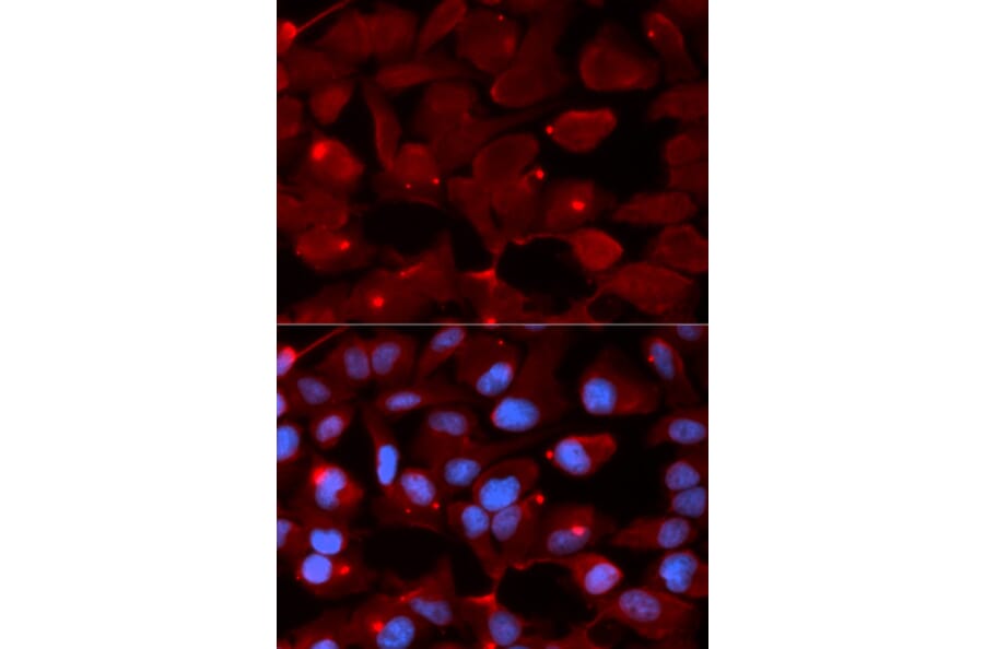 Anti-SMARCB1 Antibody from Bioworld Technology (BS7846) - Antibodies.com