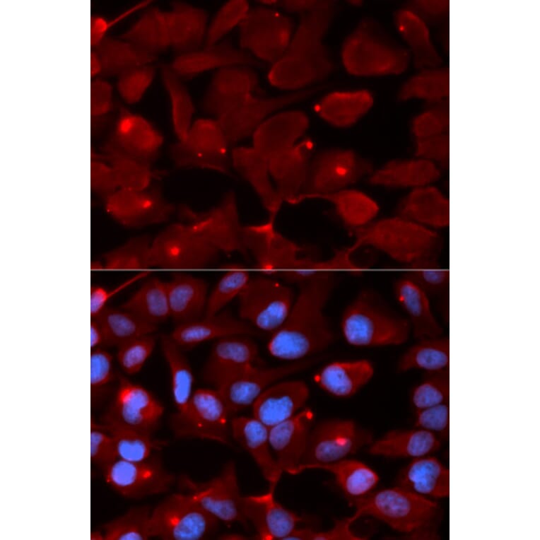 Anti-SMARCB1 Antibody from Bioworld Technology (BS7846) - Antibodies.com