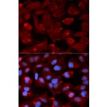 Anti-SMARCB1 Antibody from Bioworld Technology (BS7846) - Antibodies.com