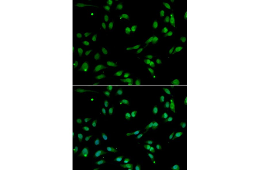 Anti-ANP32A Antibody from Bioworld Technology (BS7847) - Antibodies.com