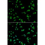 Anti-ANP32A Antibody from Bioworld Technology (BS7847) - Antibodies.com