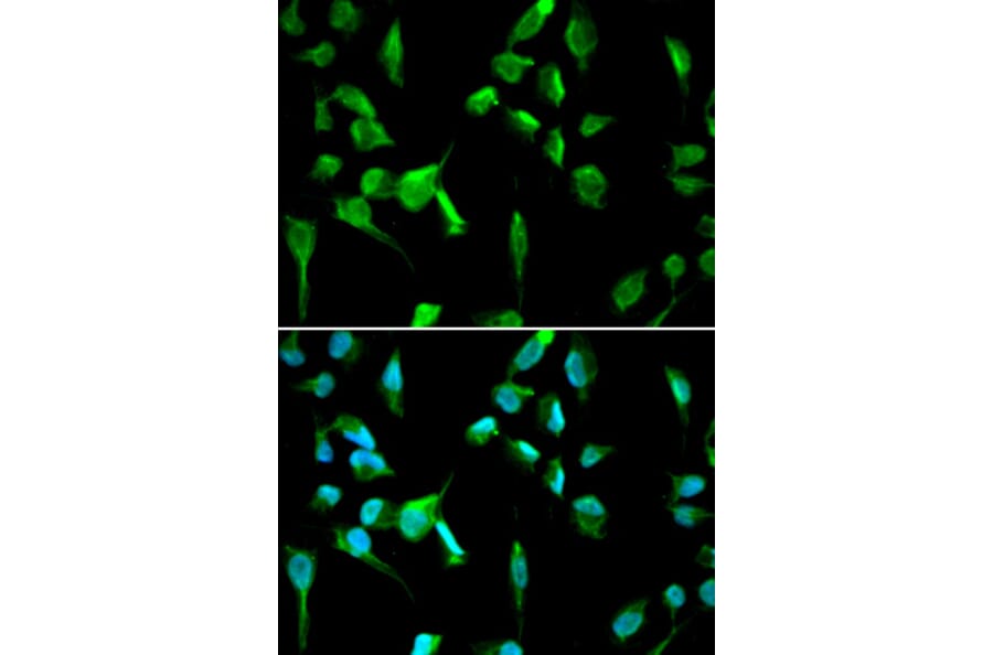 Anti-TOPBP1 Antibody from Bioworld Technology (BS7858) - Antibodies.com
